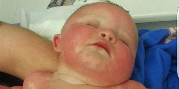 Yanlış teşhis az kalsın öldürüyordu!