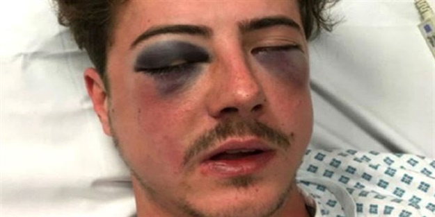 Yanlışlıkla ölesiye dövdüler