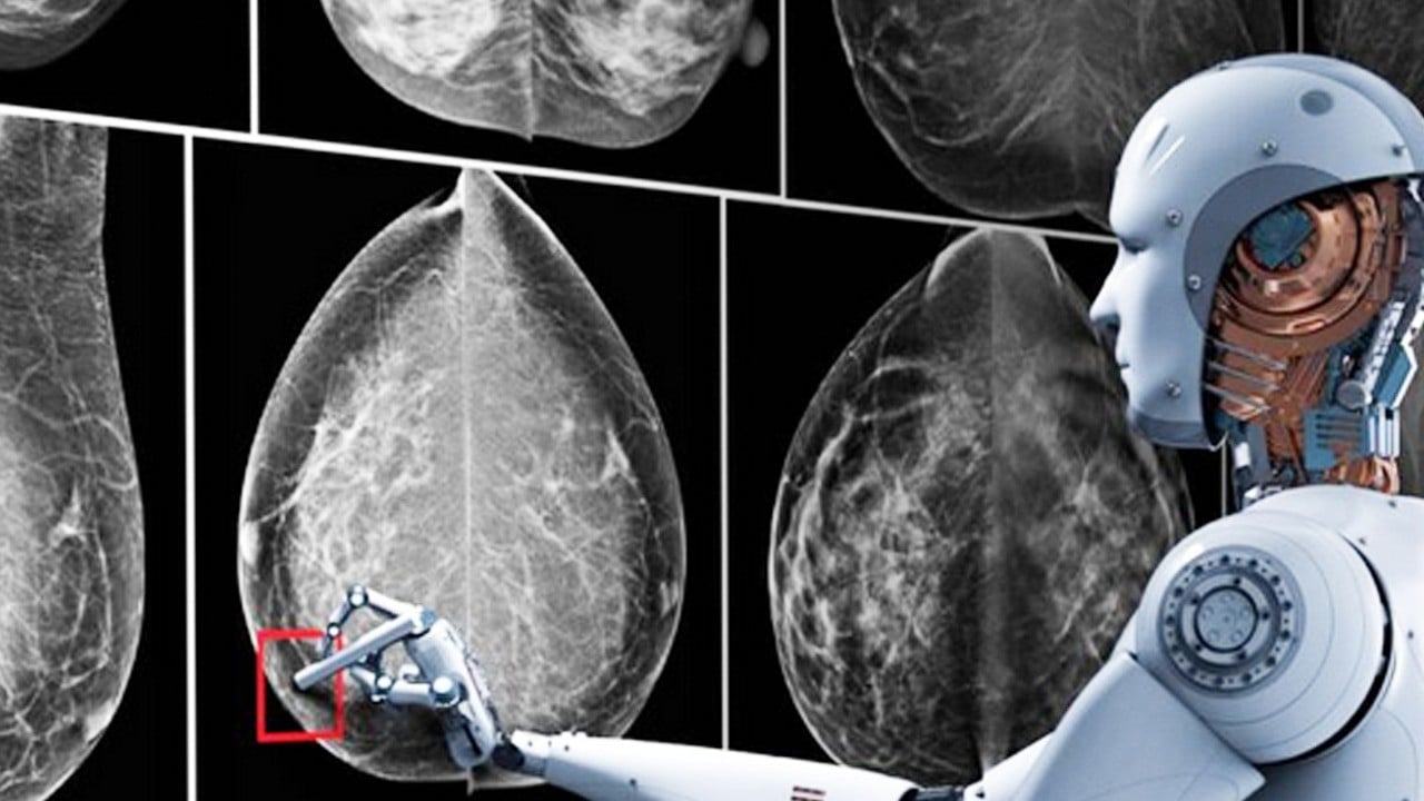 Yapay zeka kullanan teknolojilerinde yeni dönem: Uzmanlara göre erken kanser teşhisi