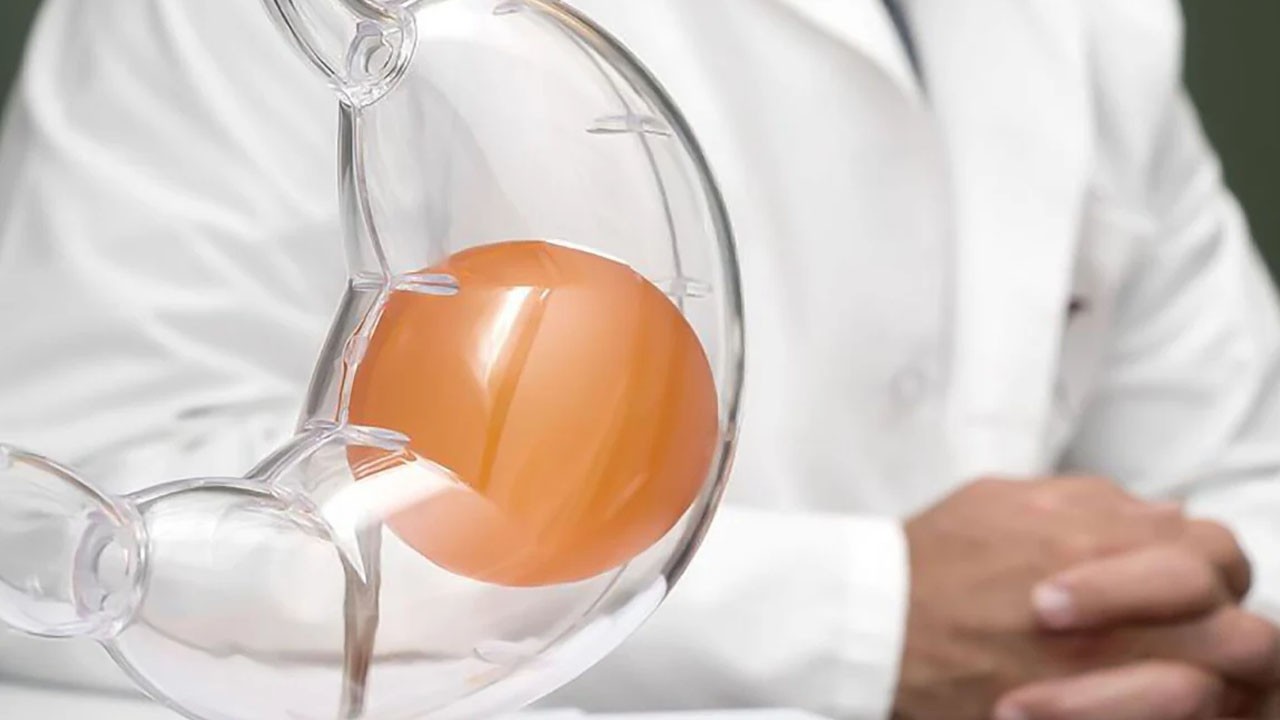 Mide balonu kanser sebebi: Yine tartışmaların odağında! Yasaklandı!