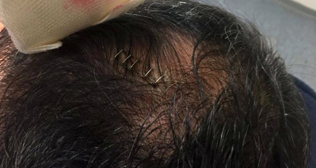 Yaralanan Şenol Güneş'le ilgili gerçek ortaya çıktı!