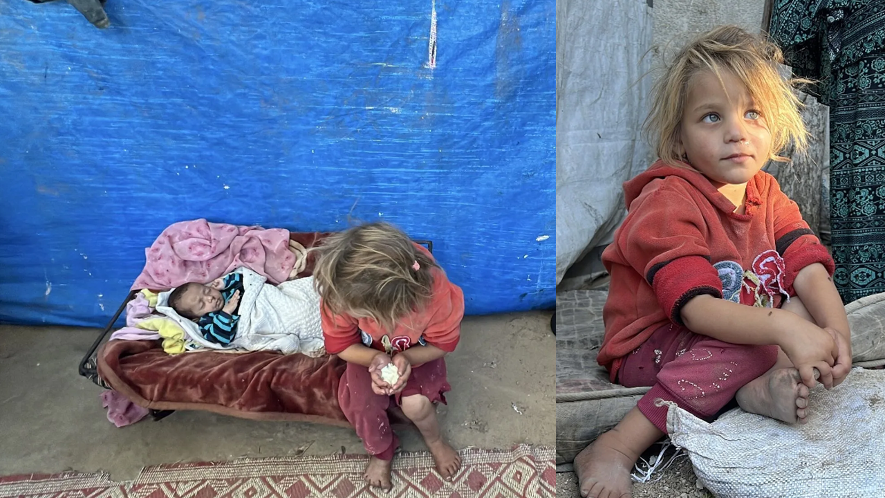 Yaralı kardeşini sırtında taşıyan Gazzeli minik, çadırda yaşam mücadelesi veriyor