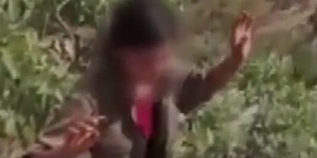 Yaralı teröriste ilk yardım Mehmetçik’ten! Kara propaganda yapan hainler iyi baksın