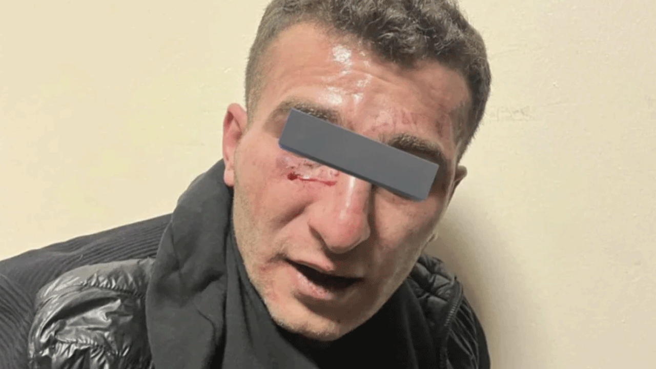 Yargı bunu kodese tıkamasında ne yapsın: Polis saldırganından korkunç ifade!