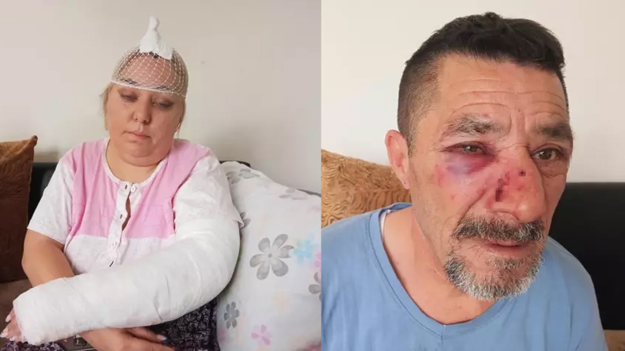 Yasal kira zammının 5 katı üzerinde artış talep etmişti! Ev sahibi zammı kabul etmeyen baba ve kızı öldüresiye dövdü