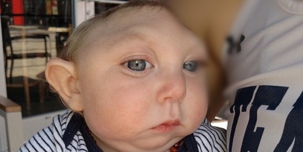 Yaşamaz denilen o bebek 1 yaşında - FOTO