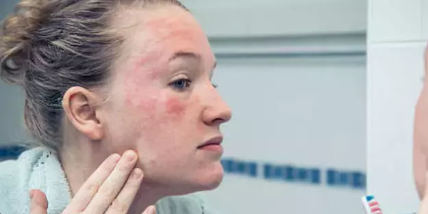 Yaşlandıkça çöken göz altlarını 10 yaş gençleştiriyor: İyi gelen nedir ve nasıl kullanılır?