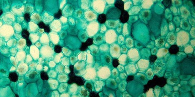 Yaşlanmayla ilgili protein keşfedildi