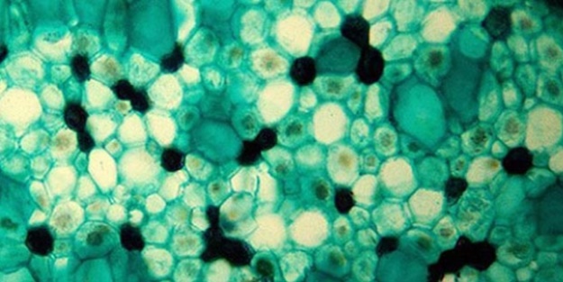 Yaşlanmayla ilgili yeni bir protein keşfedildi