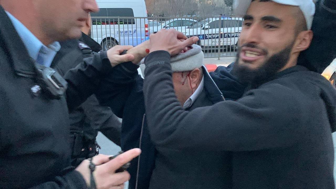 Yaşlı Filistinlinin başını yardılar!