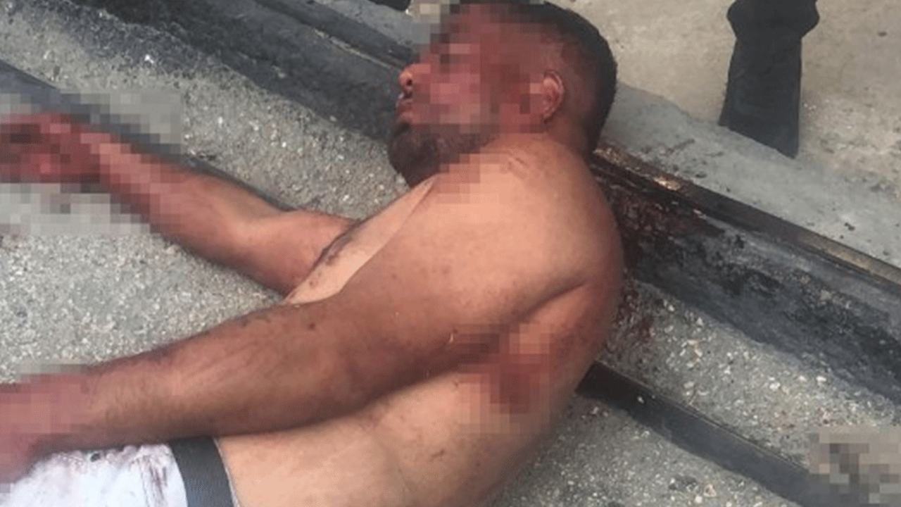 Yaşlı kadını darp eden şüpheli yakalandı!