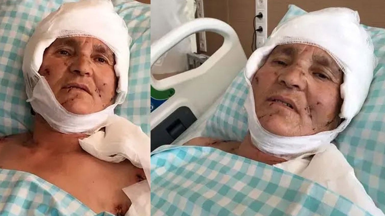 Yaşlı kadının kulak ve kolları parçalanmıştı! Vahşi köpek sahiplerine rekor tazminat cezası
