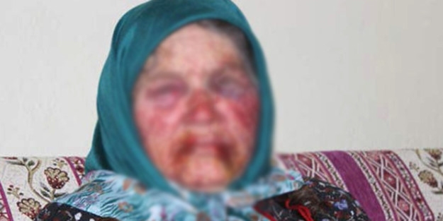 Yaşlı teyzeyi bu hale getiren magandalar yakalandı