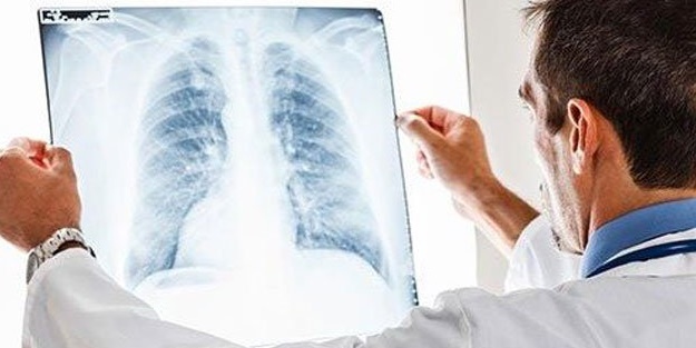 Yaşlıların ve çocukların kabusu 'Zatürre'