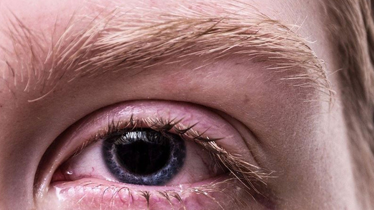 Yaz aylarında bu hatalara dikkat! Masum değil körlüğe yol açabilir