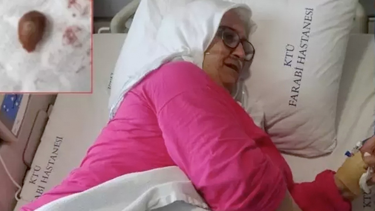 Yediği kuruyemiş ciğerini çürüttü: 'Bir daha yemem'