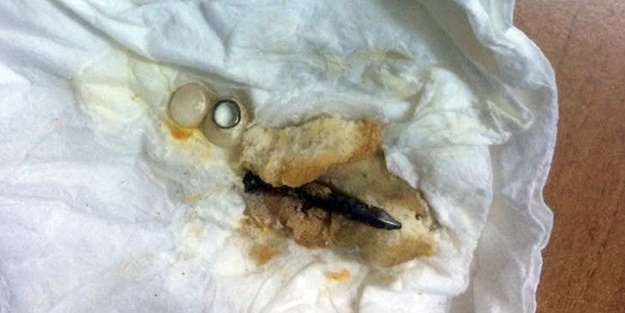 Yediği pideden öyle bir şey çıktı ki 4 dişi kırıldı