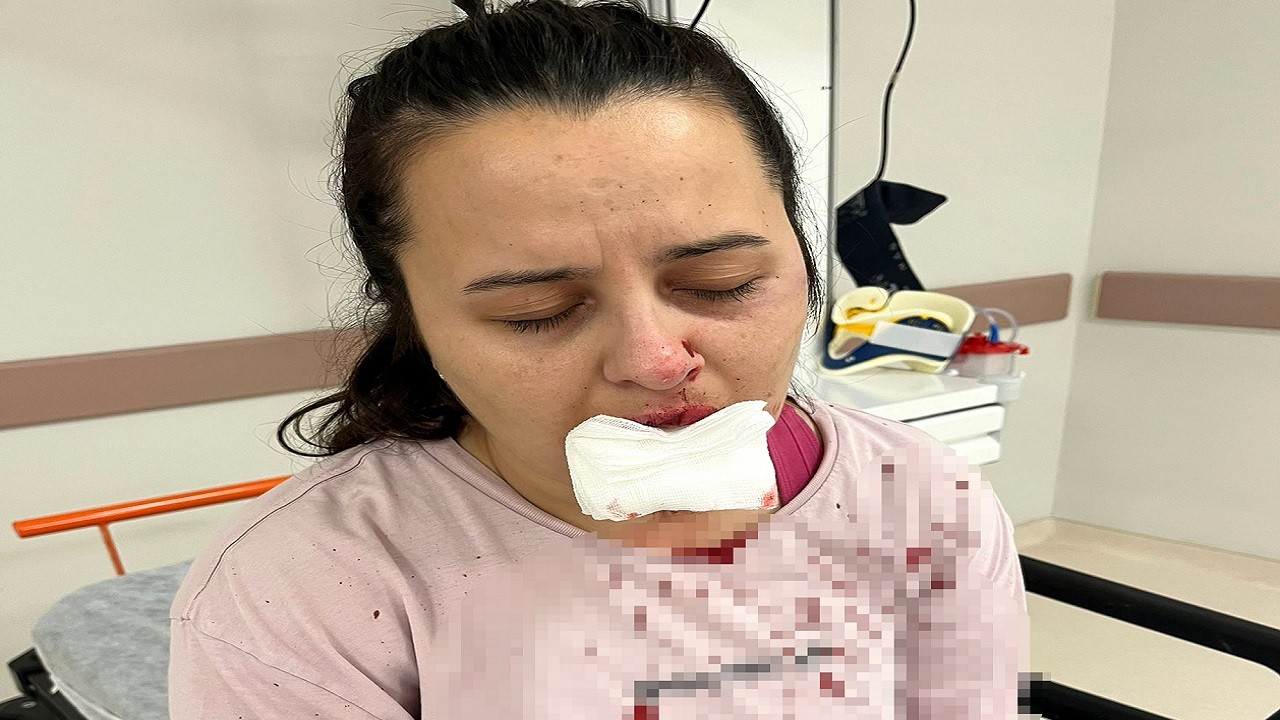 Yeğeninin çenesini balyozla kırdı!