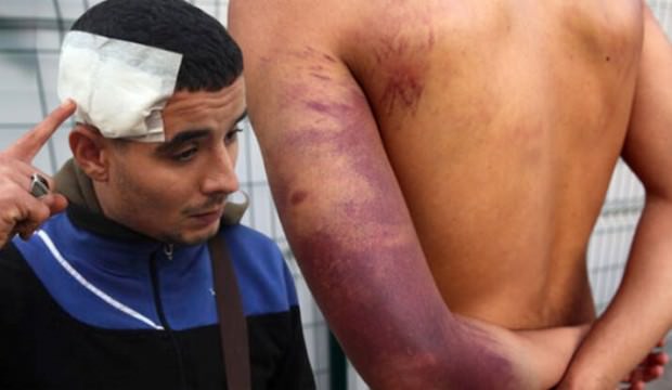 'Yemek ve su vermediler! Yunan askeri tüfekle dövdü'