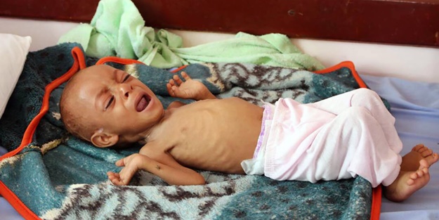 Yemen Cumhurbaşkanı Hadi'den acil çağrı