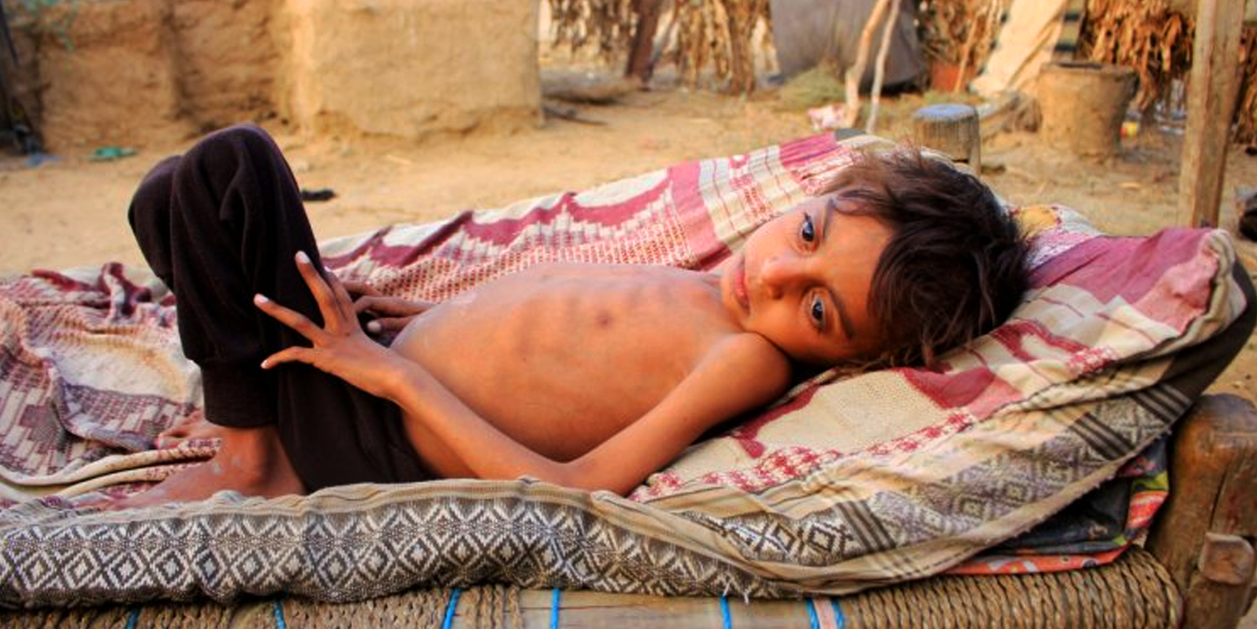 Yemen’de 2 milyon çocuk ölmek üzere!