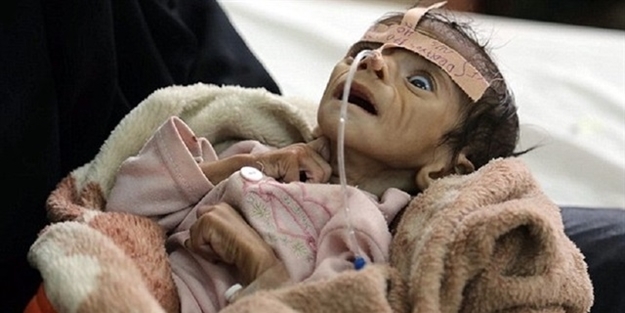 Müslümanlar ölüyor duyuyor musunuz?