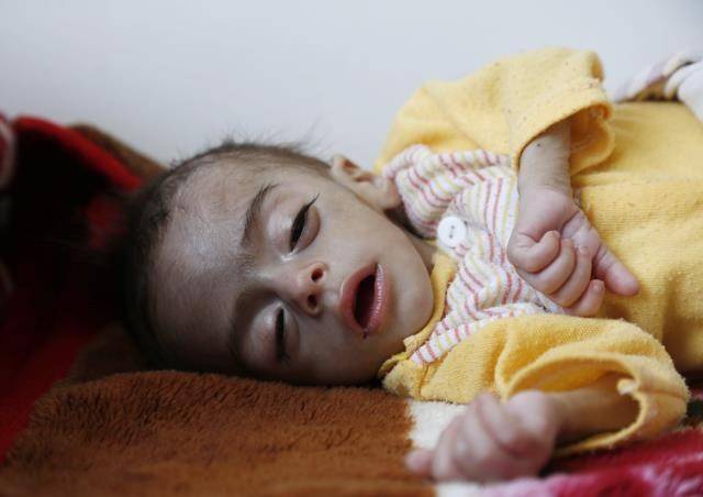 Yemen’de kıtlık çocukların hayatını tehdit ediyor