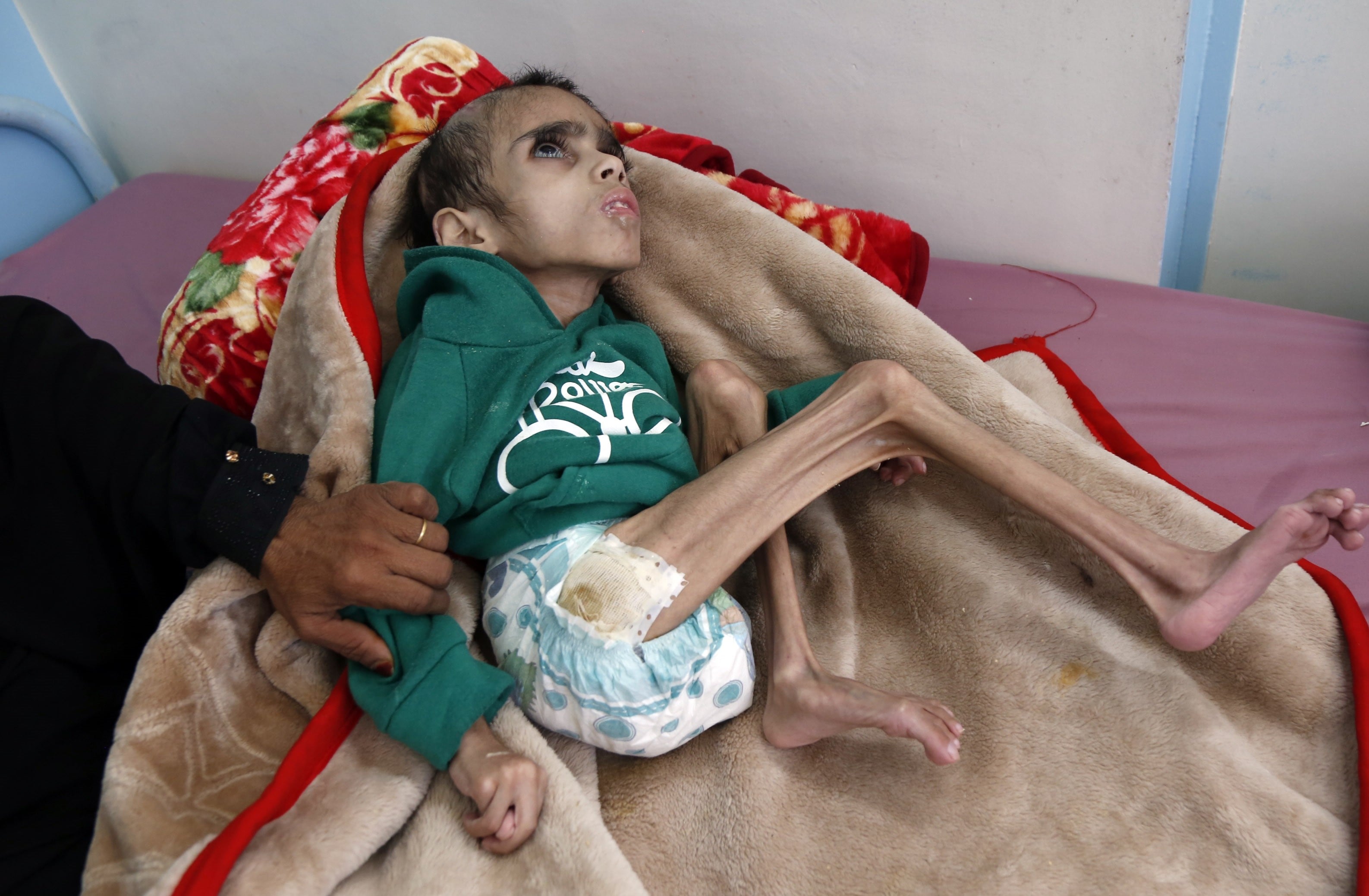Yemen'deki insani kriz 2020 yılında daha da derinleşti