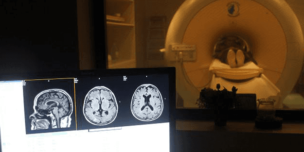 Yeni bir hastalık daha çıktı! Gençler arasında hızla yayılıyor