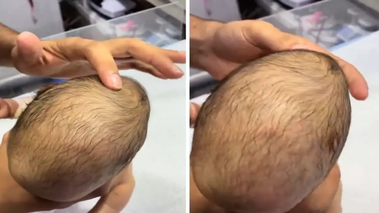 Yeni doğan bebeğin bıngıldağına basan doktorun gördüğü manzara şok etti