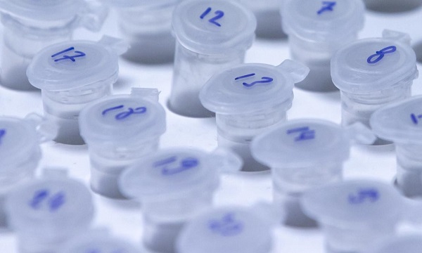 Yerli aşı ne zaman yapılacak? Yerli aşı bulundu mu?