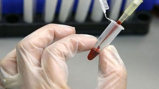 Yerli kanser ilacı için harekete geçildi