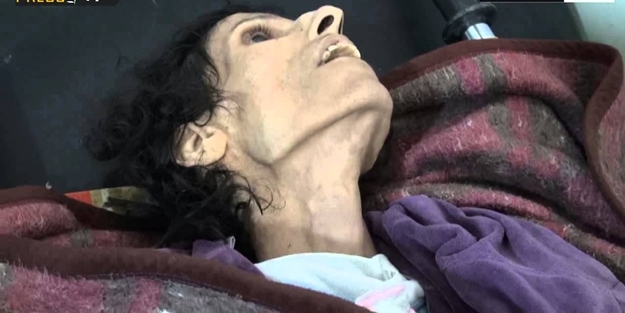 Yermuk Kampı’nda yürek burkan trajedi