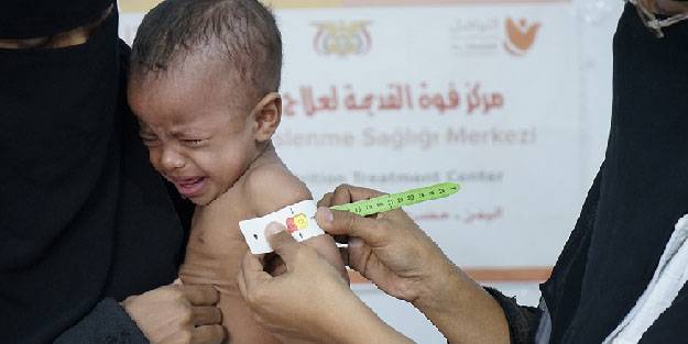 Yeryüzü Doktorları Yemen'de binlerce anne ve çocuğuna beslenme tedavisi uyguladı