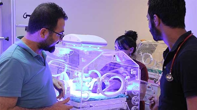 'Yılan bebek' dünyaya geldi