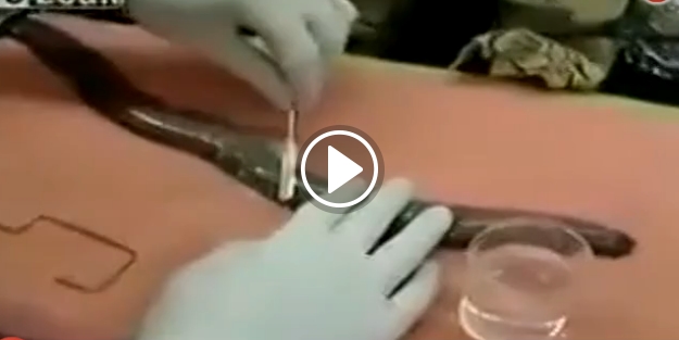 Yılan zehri bakın suyu ne hale getirdi