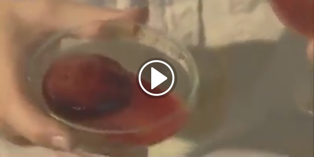 Yılan zehiri bakın ne hale getiriyor!