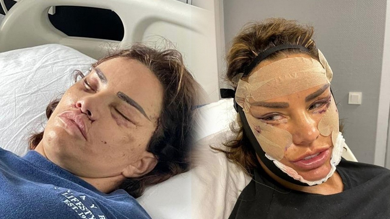 Dünyaca ünlü Katie Price iflas etti! Onlarca ameliyat oldu...