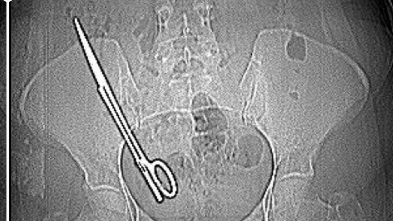 Yıllardır bu ağrıyı çekiyordu! Gerçek tam 7 yıl sonra ortaya çıktı