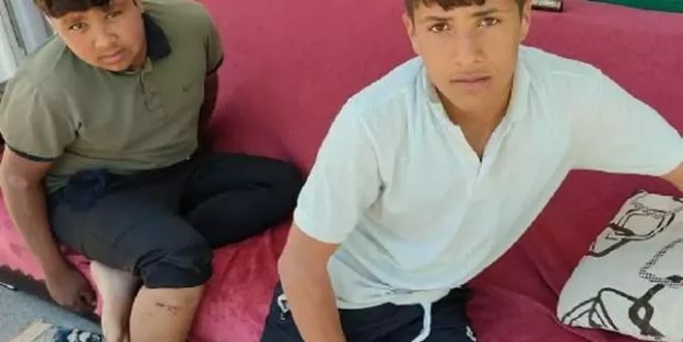 Yine köpek saldırısı! İki çocuk hastanelik oldu