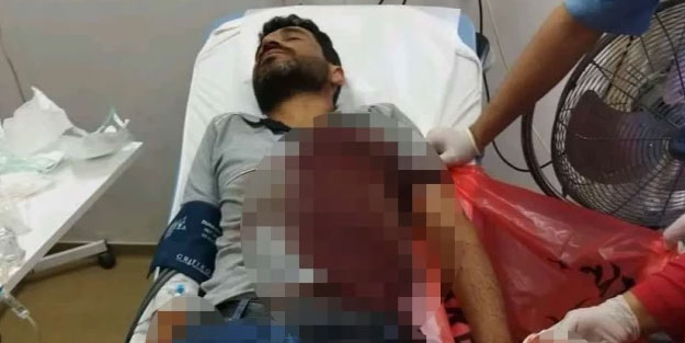 Yine köpek vahşeti! Kimse dur diyemiyor