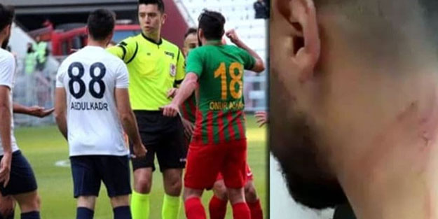 Yine Mansur Çalar yine skandal! Jiletçi futbolcu futbola zarar vermeye devam ediyor