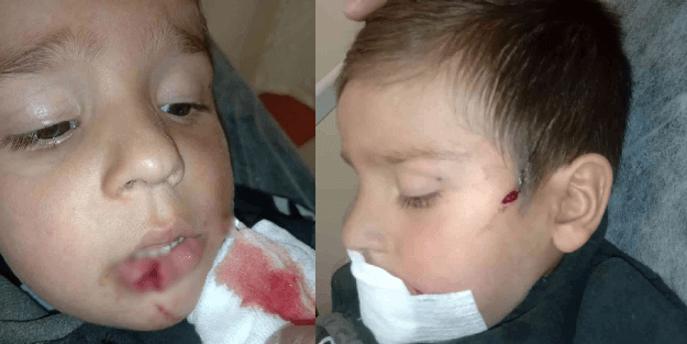 Yine sokak köpeği dehşeti!