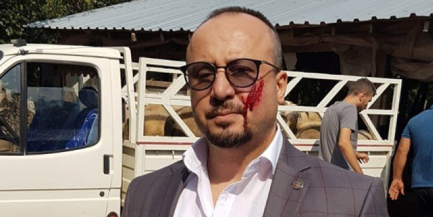 Yok artık! Avukatı ısırdı