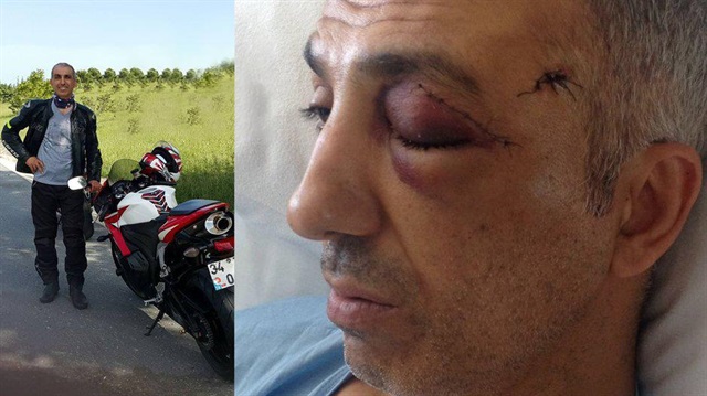 Yorgun mermi dehşeti: Kaskını delip çenesine saplandı