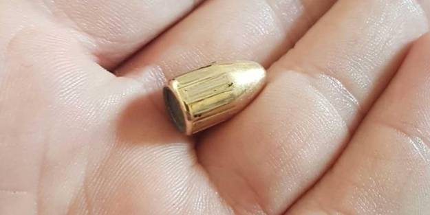 Yorgun mermiyle yaralandı!