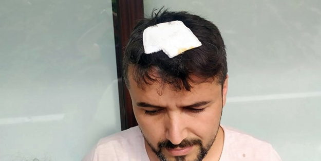 Yorgun mermiyle yaralandı