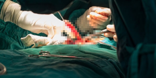 Yumurtalığından beyin çıktı!