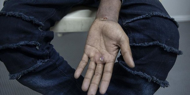 Yunan askerleri düzensiz göçmenin ellerinde sigara söndürdü