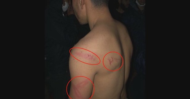 Yunan’ın insanlığı bu kadar